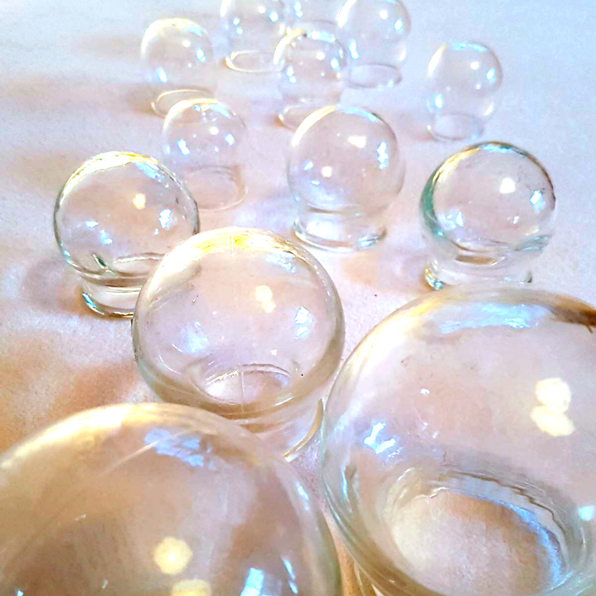 Schröpfen Schröpfen in Konstanz, Überlingen und Tettnang